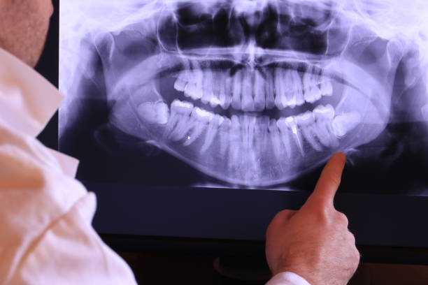 Best Emergency Treatment for Toothache in Rock Hill, NY